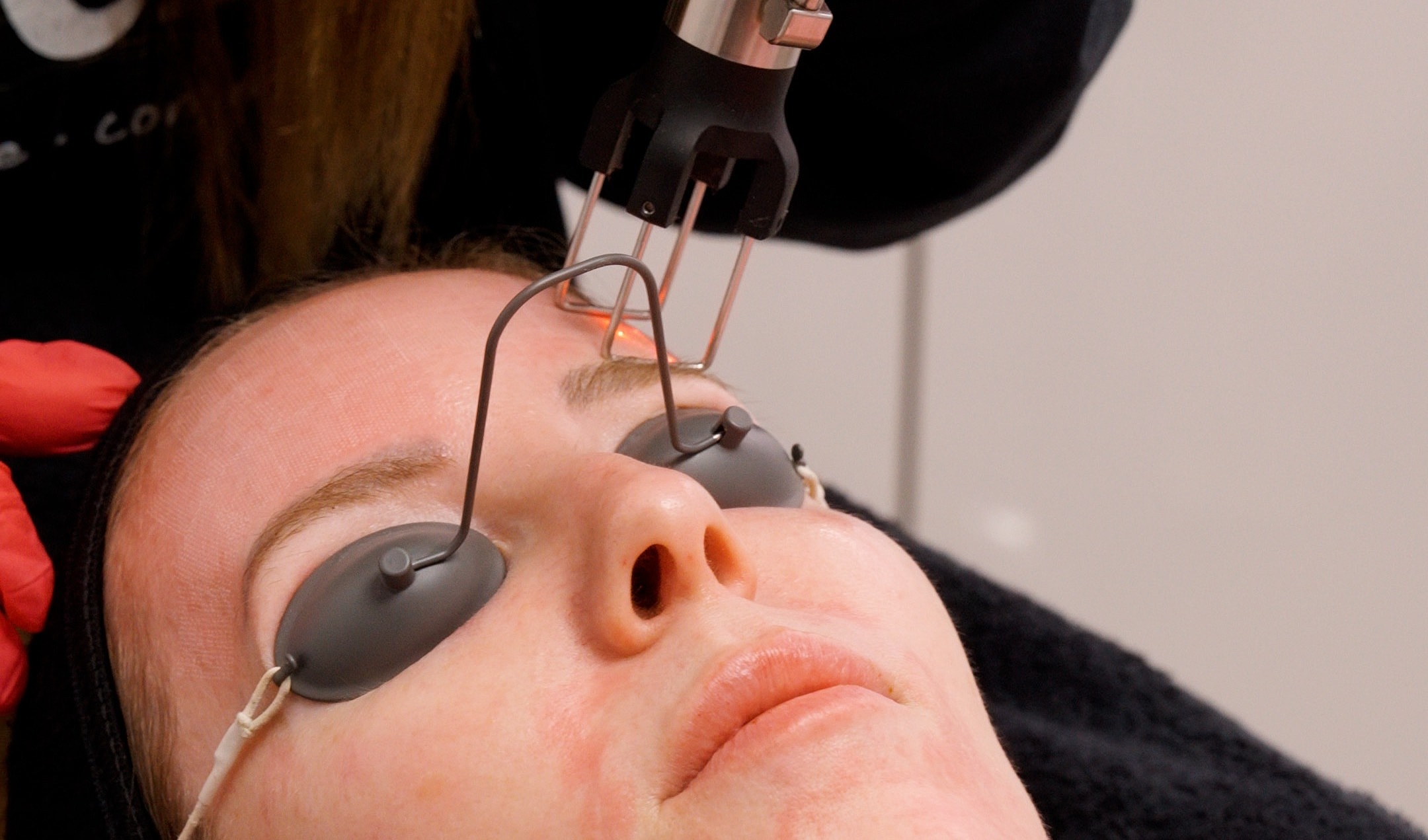 Skincare treatment with laser device in progress.