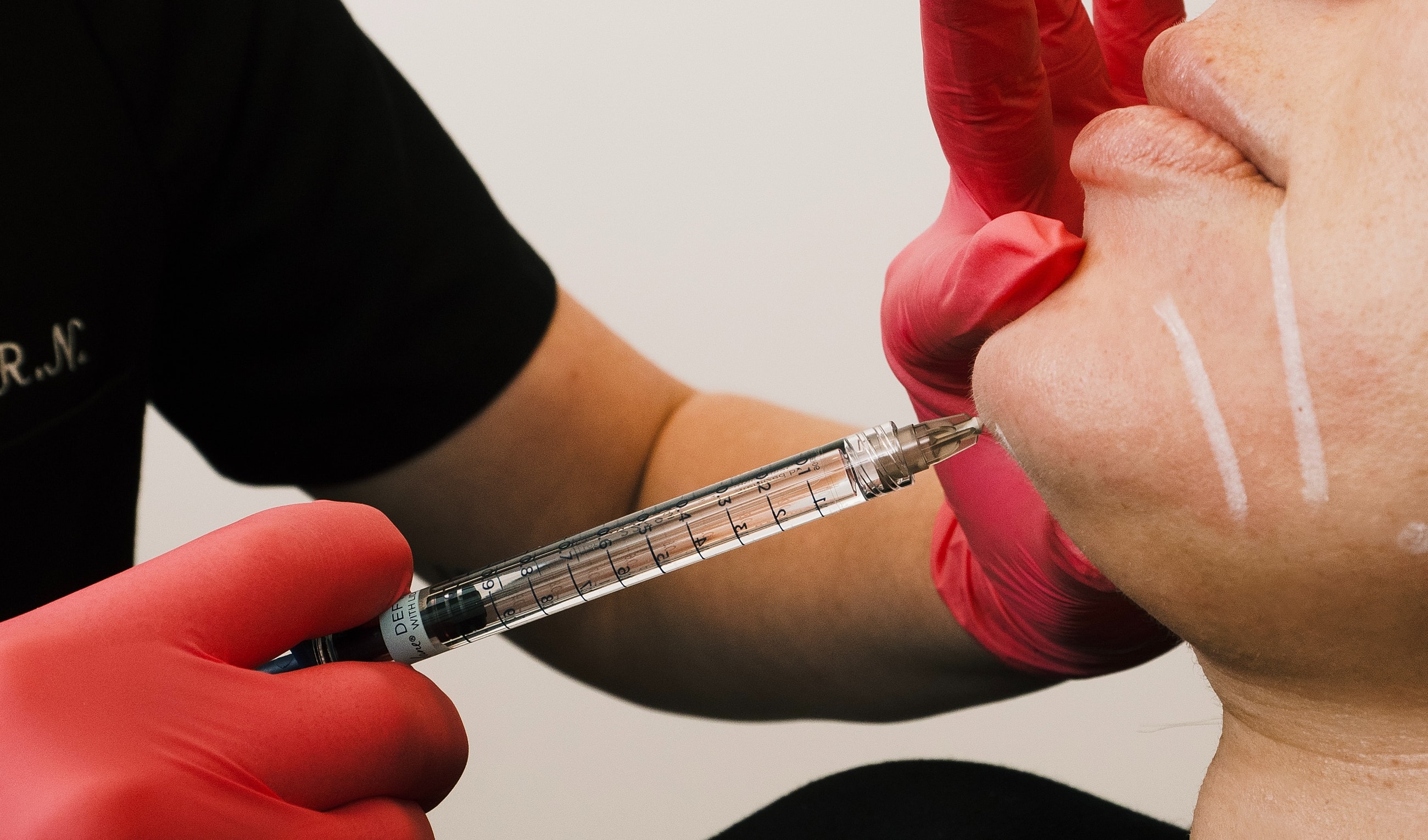 Administering cosmetic injection to client's chin.